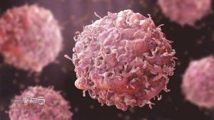 শরীরে ক্যানসারের ইঙ্গিত দেয় যেসব লক্ষণ